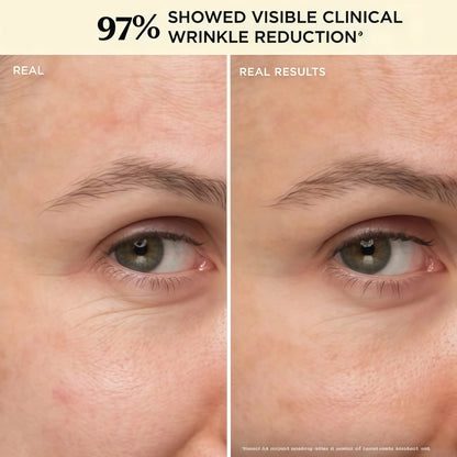 IT Cosmetics Confidence in a Cream - Face Moisturizer, Hydrating & Anti Aging, Visibly Reduces Fine Lines & Wrinkles, 48H Hydration, Repairs Skin Barrier, Squalane, Ceramides, For All Skin Types